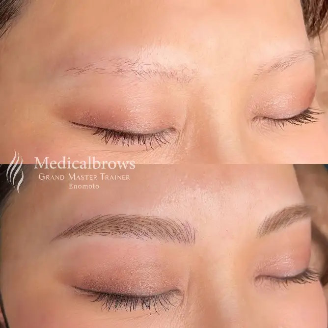 榎本 アートメイク症例写真