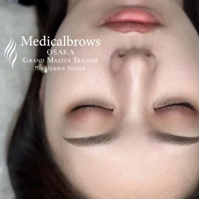 西山（優） アートメイク症例写真