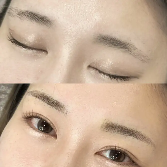 山尾 アートメイク症例写真