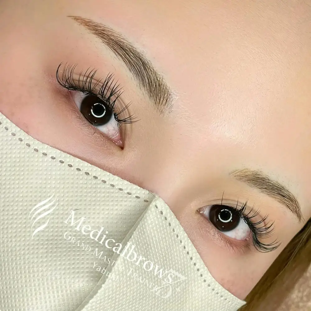 コンビネーション（毛並み＋パウダー）症例1