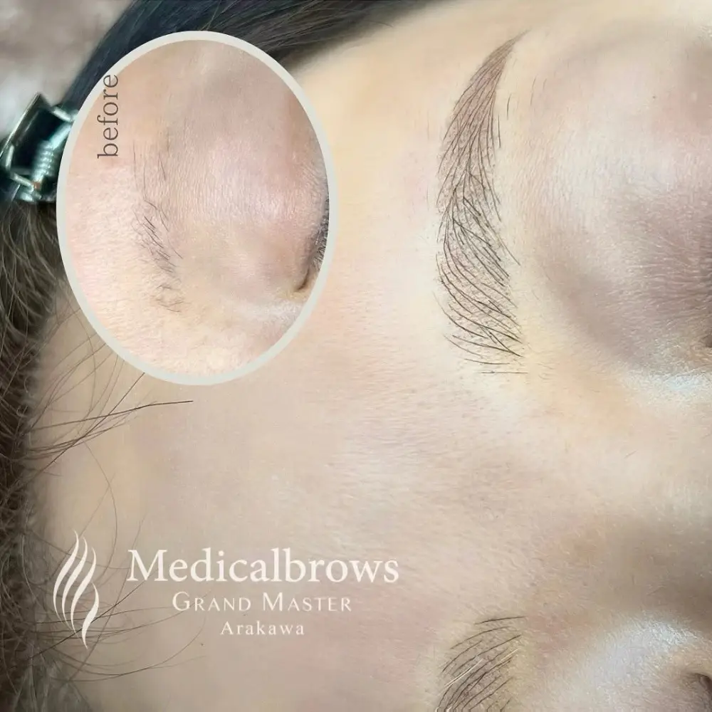 コンビネーション（毛並み＋パウダー）症例2