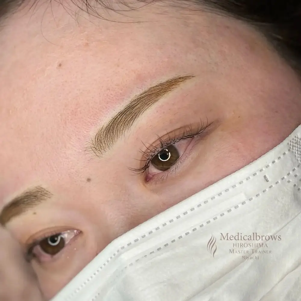 コンビネーション（毛並み＋パウダー）症例3