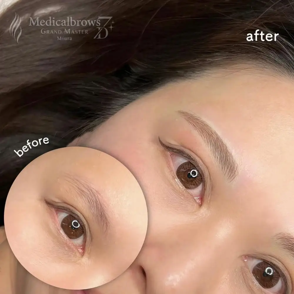 マイクロブレーディング（手彫り）症例1