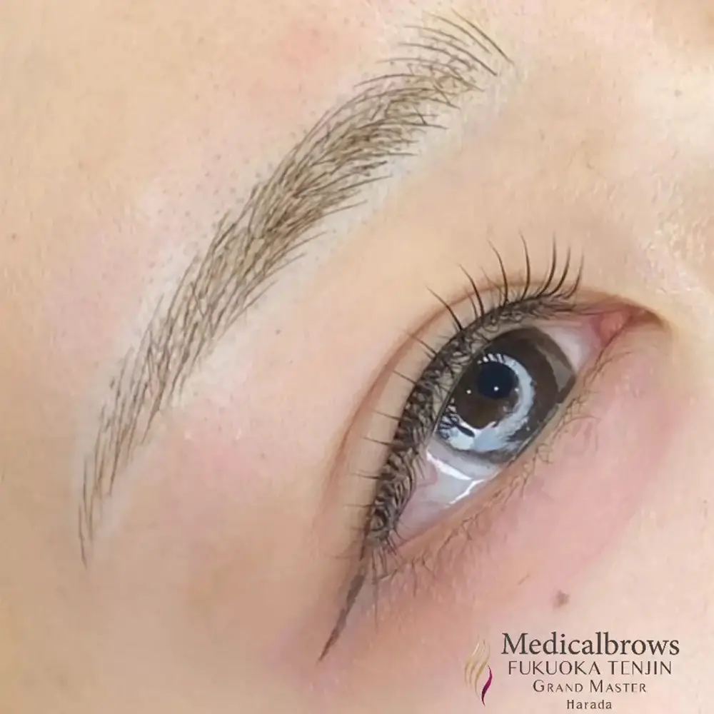 マイクロブレーディング（手彫り）症例2