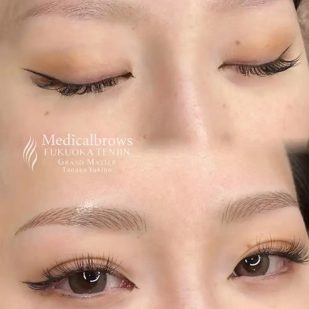 マイクロブレーディング（手彫り）症例3