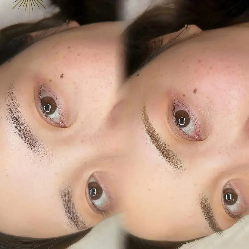 パウダー（マシン彫り）症例2