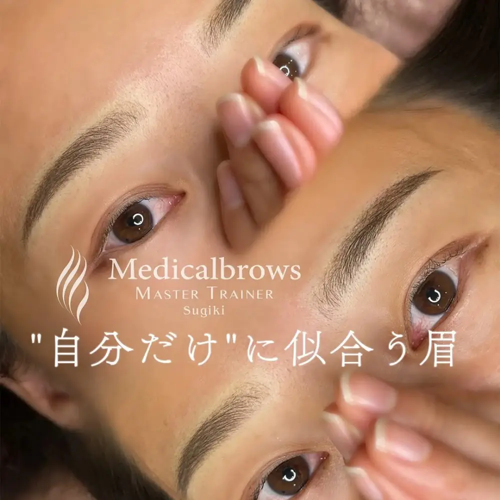 パウダー（マシン彫り）症例3