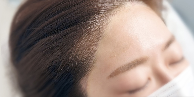 ヘアライン 参考イメージ