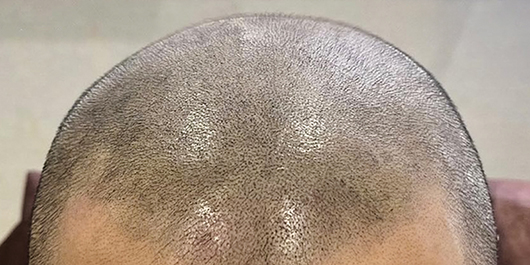 SMP 参考イメージ