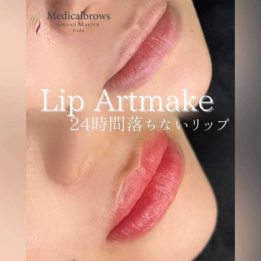 フルリップ 症例1