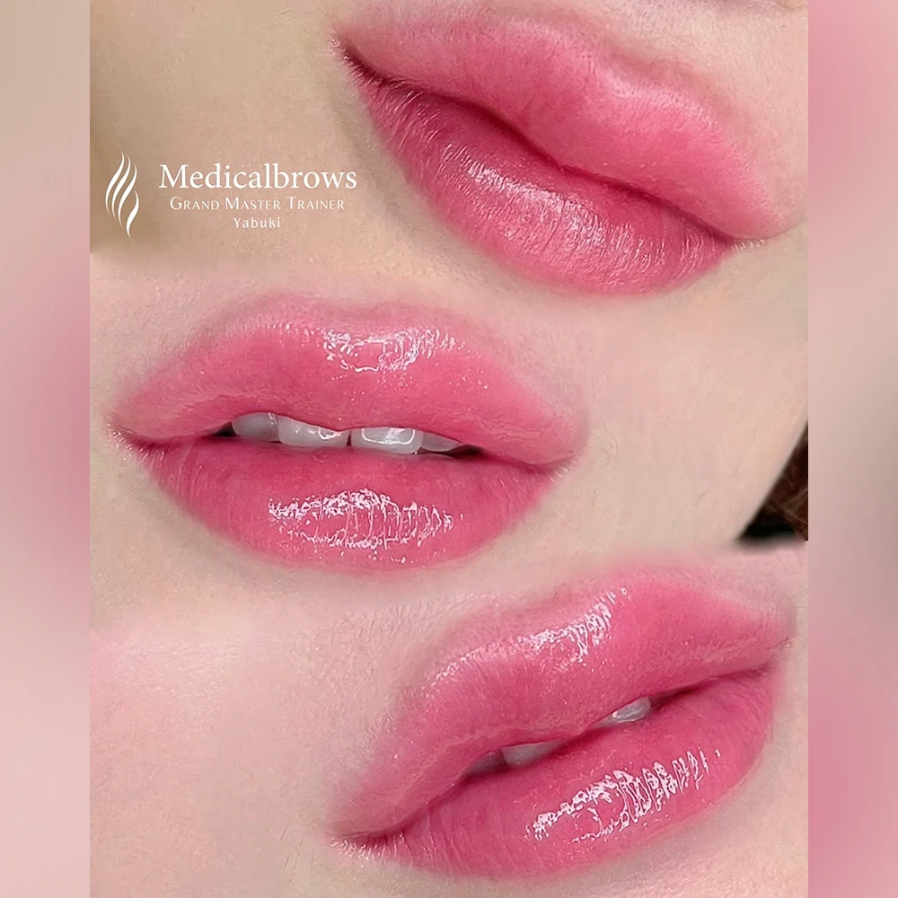 フルリップ 症例2