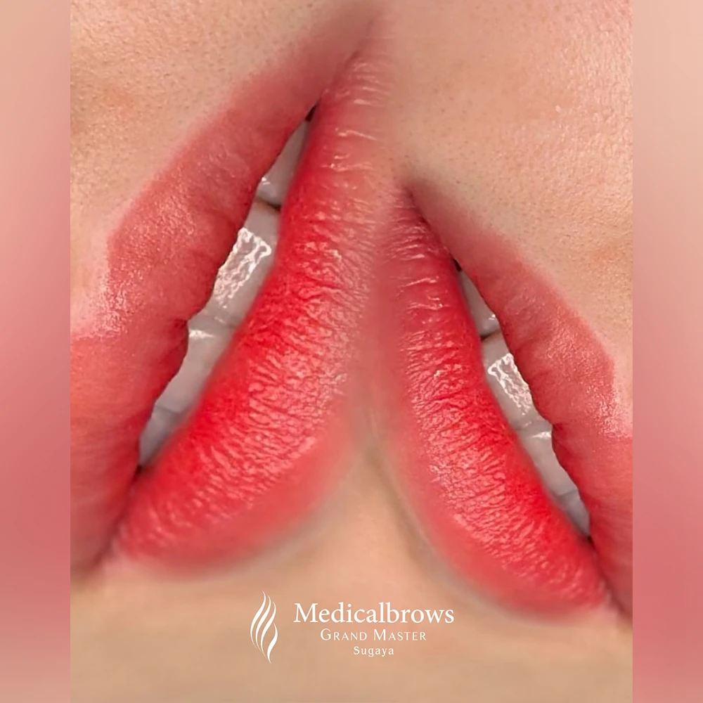 グラデーションリップ 症例2