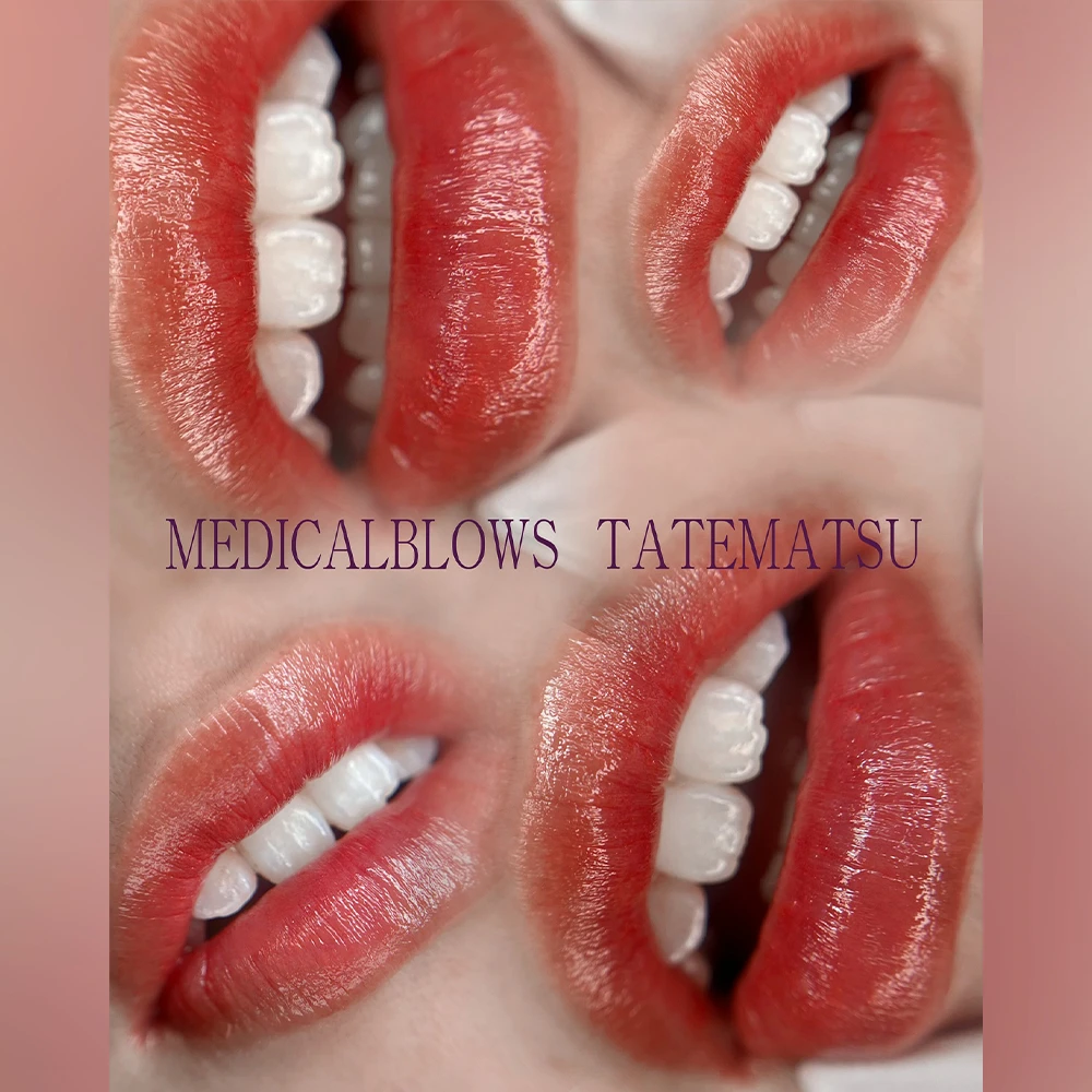 グラデーションリップ 症例3