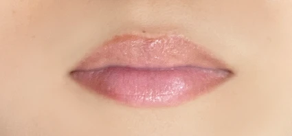 施術3回目 Before前