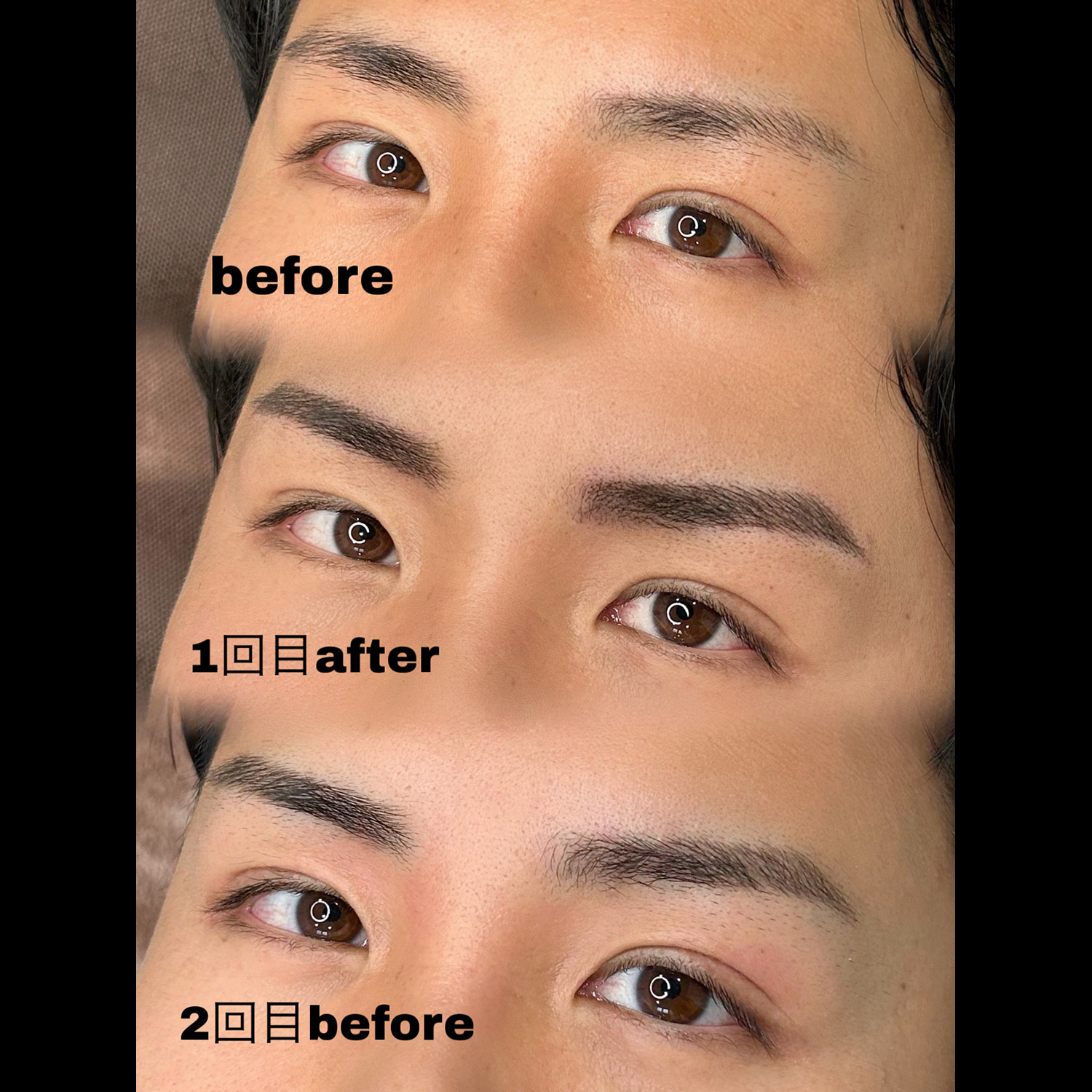 メディカルブロー 山本 症例写真1