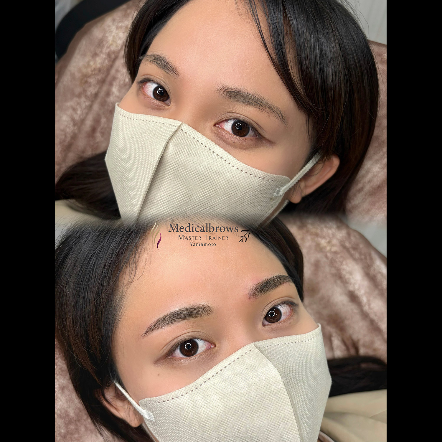 メディカルブロー 山本 症例写真2