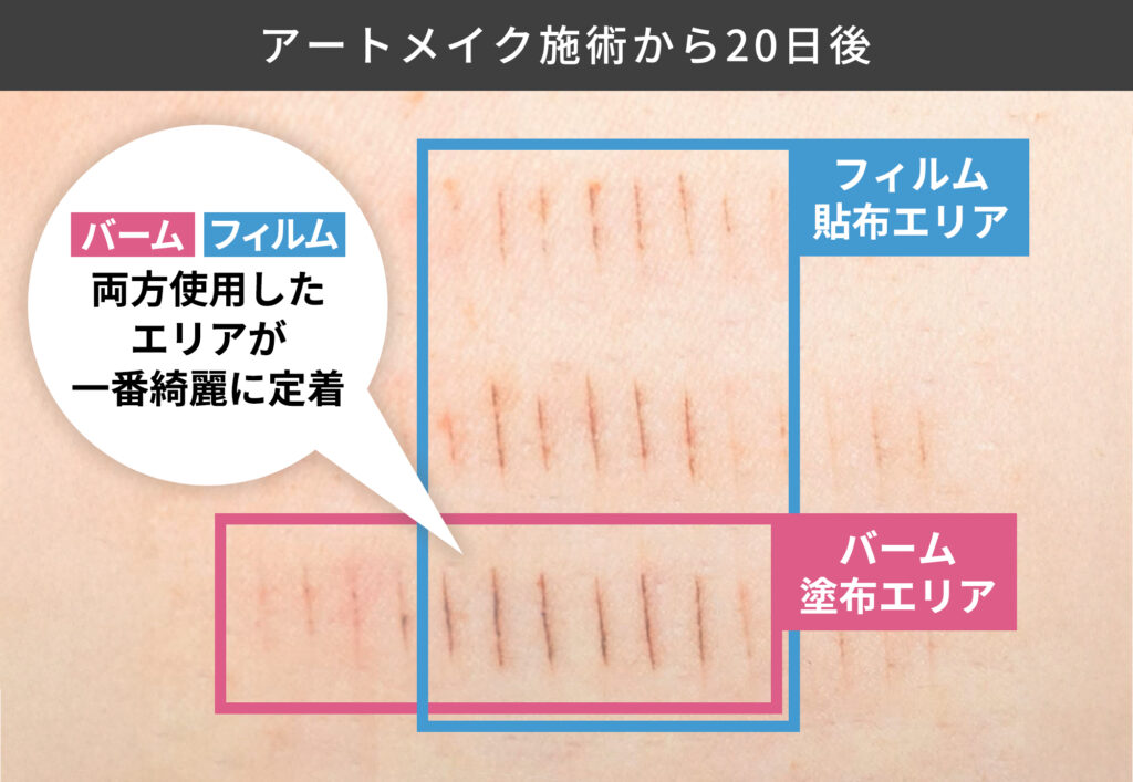 アートメイク専用のアフターケアアイテムを使用した症例写真