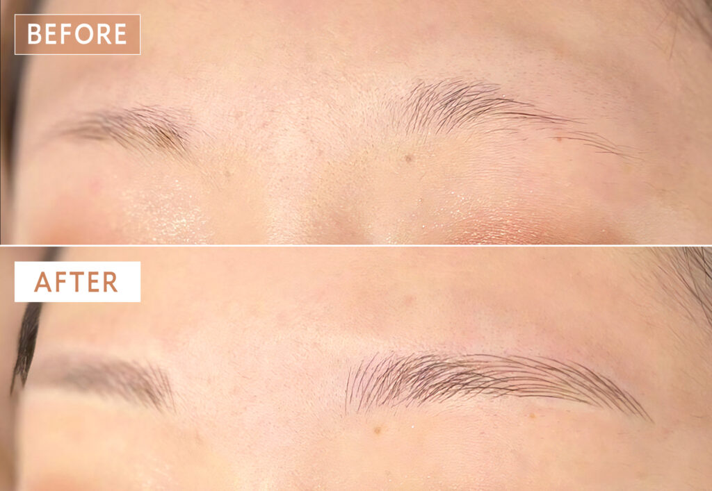 眉毛アートメイク症例写真