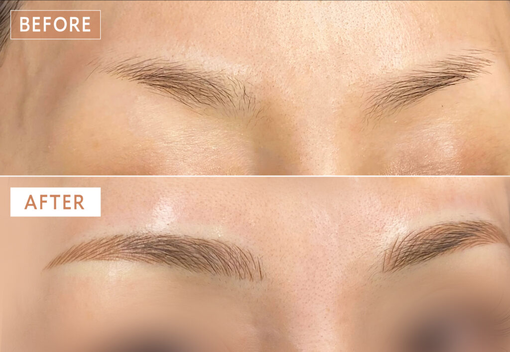 上がり眉をアートメイクでなだらかにした症例