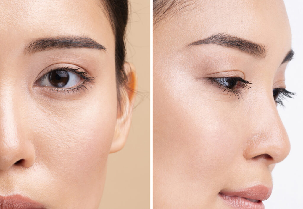 横から見た眉毛が跳ね上がってしまっている女性