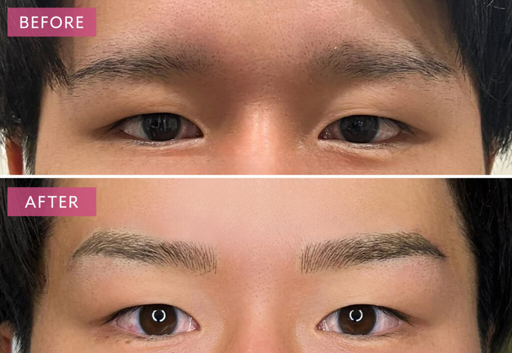 山ありストレート眉のアートメイク症例