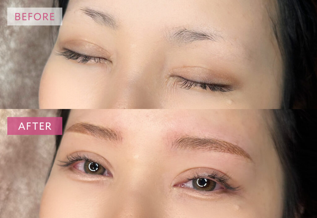 眉アートメイク症例写真