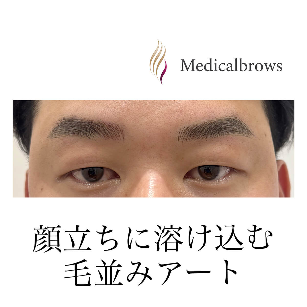 メディカルブロー 南舘 症例写真1