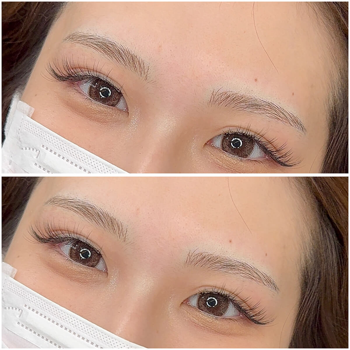 メディカルブロー 南舘 症例写真2