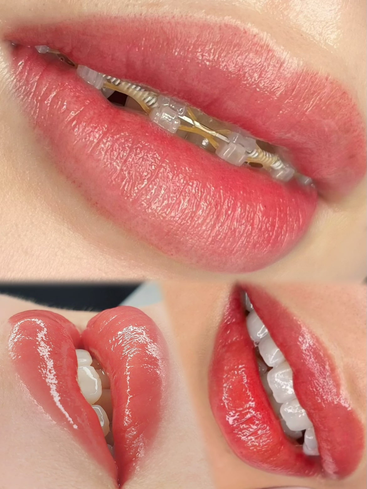 メディカルブロー 髙木 症例写真1