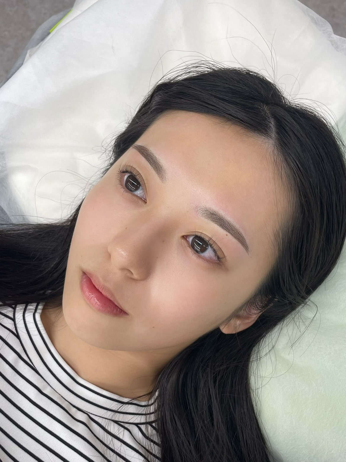 メディカルブロー 髙木 症例写真2