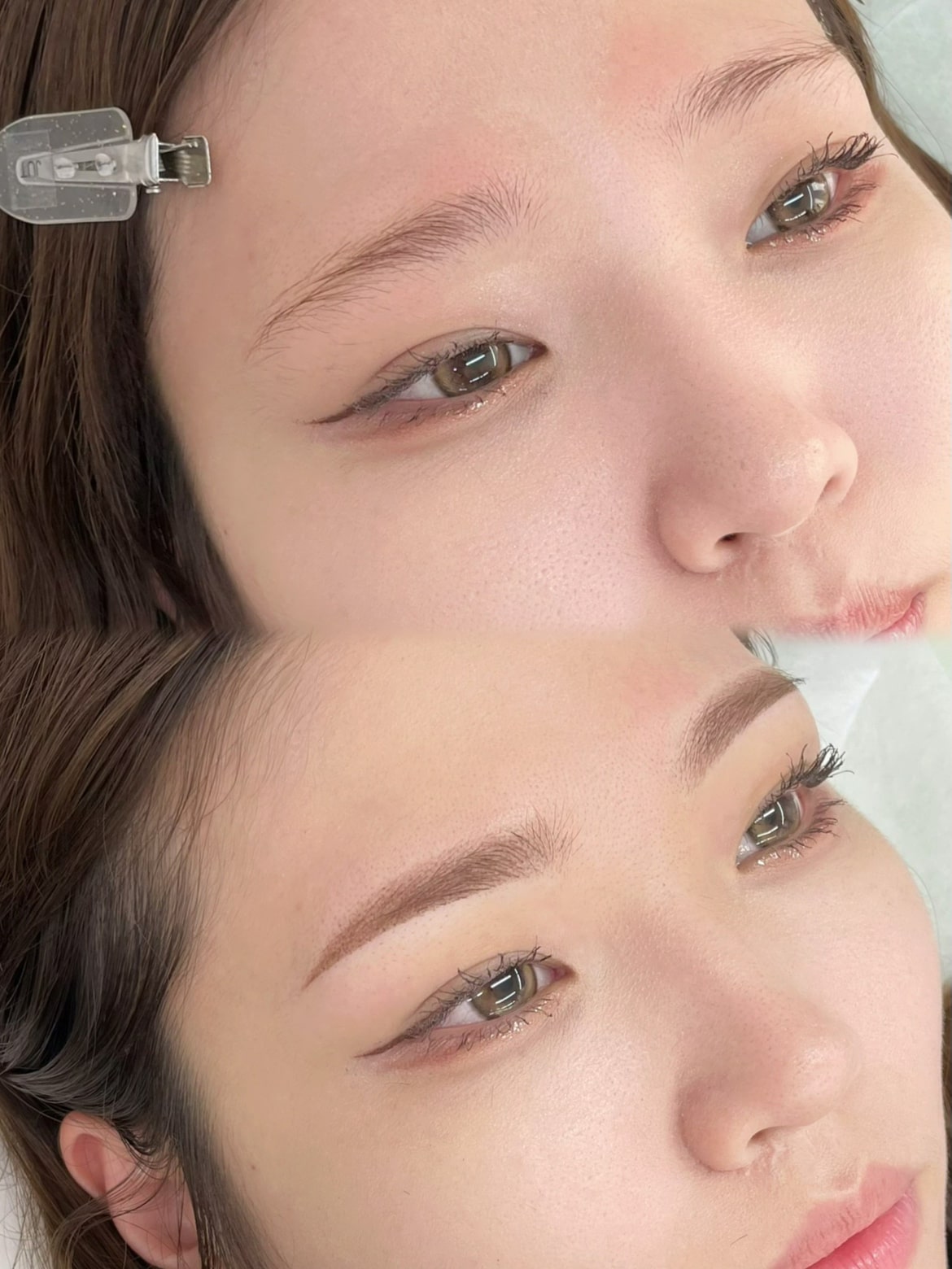 メディカルブロー 髙木 症例写真3