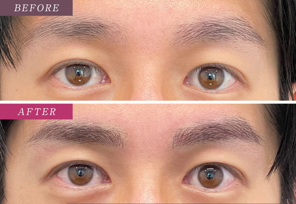 メンズ眉毛アートメイクの症例写真