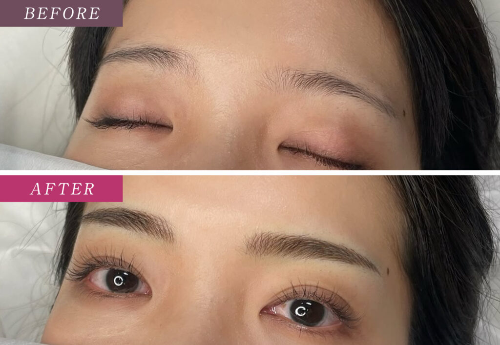 眉毛アートメイクの症例写真