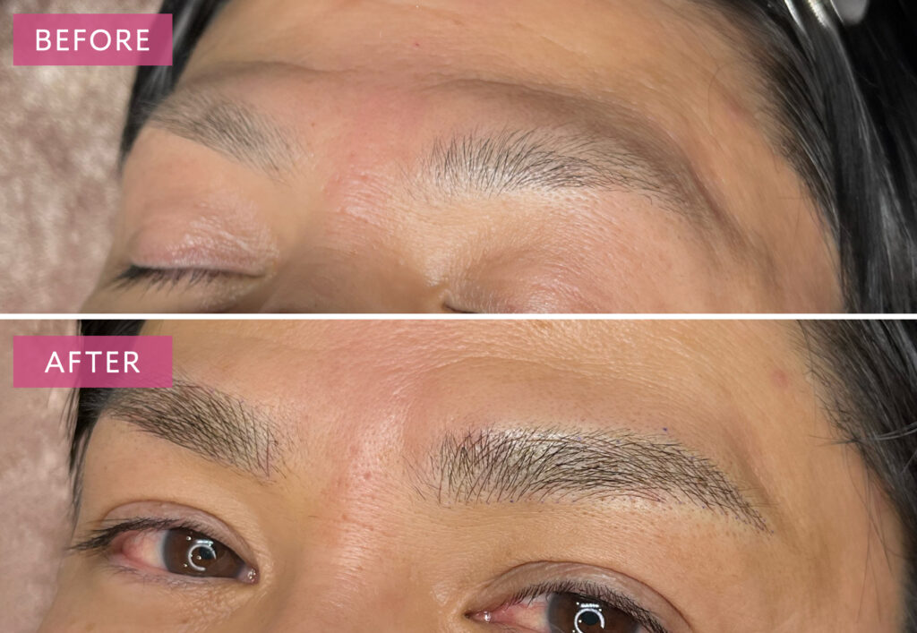 メンズ眉アートメイクの症例写真