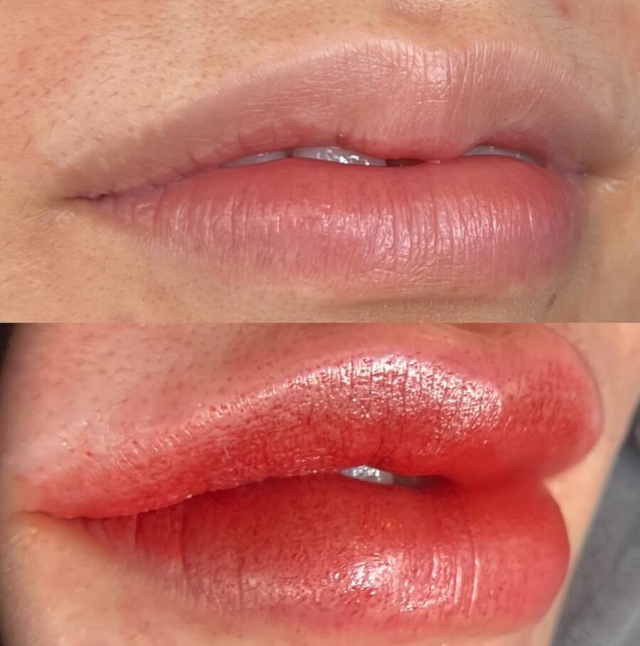 メディカルブロー 鵜澤 美保 症例写真1