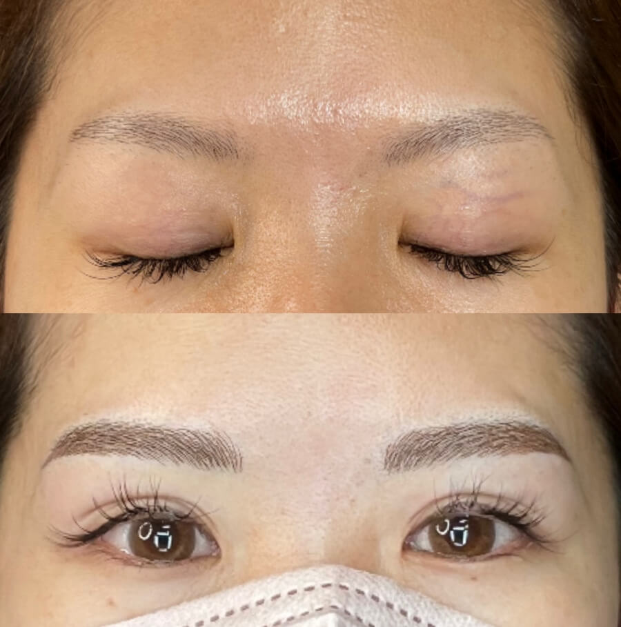 メディカルブロー 鵜澤 美保 症例写真3