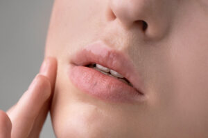 唇の色素沈着を治すには？｜原因・セルフケア・治療法を徹底解説