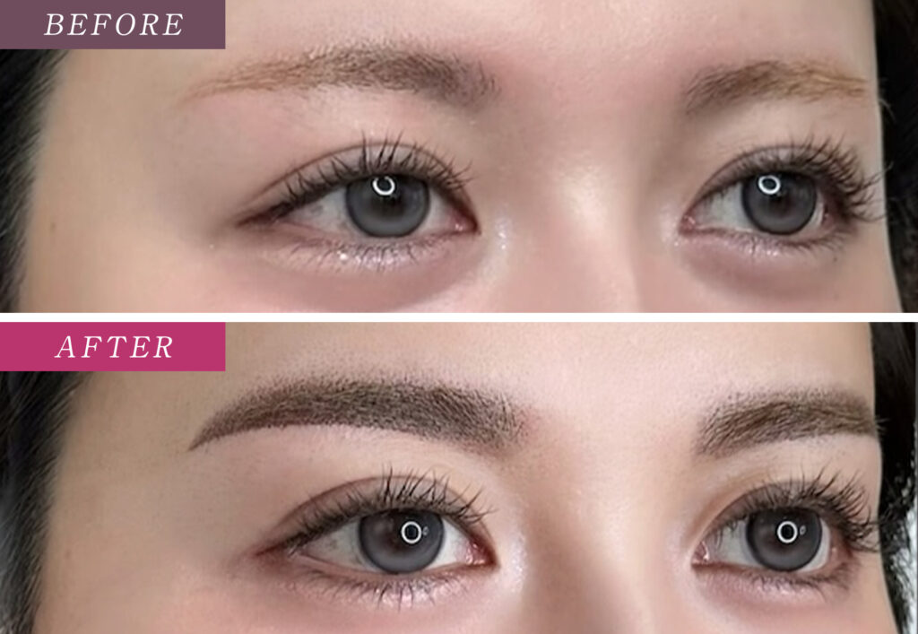 眉毛アートメイクの症例写真