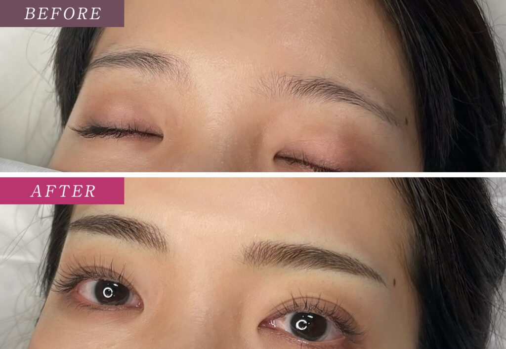 眉毛アートメイク症例写真