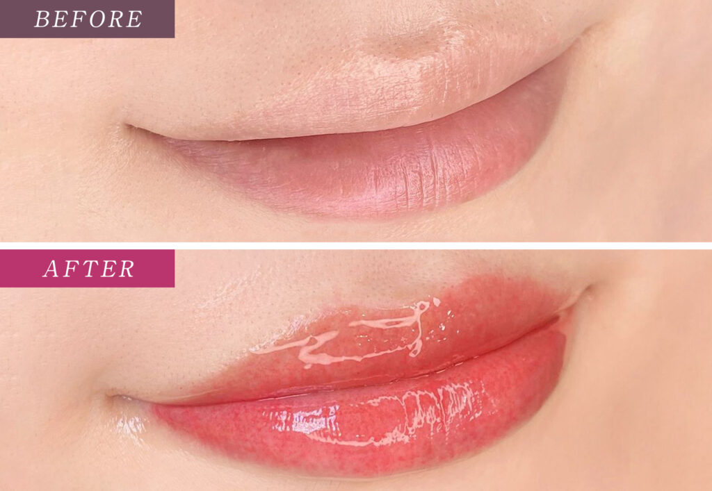 リップアートメイクの症例写真
