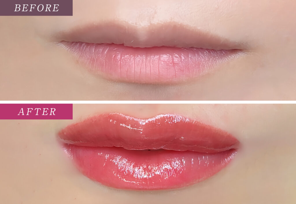 リップアートメイクの症例写真