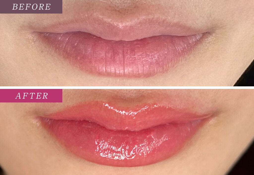 リップアートメイクの症例写真