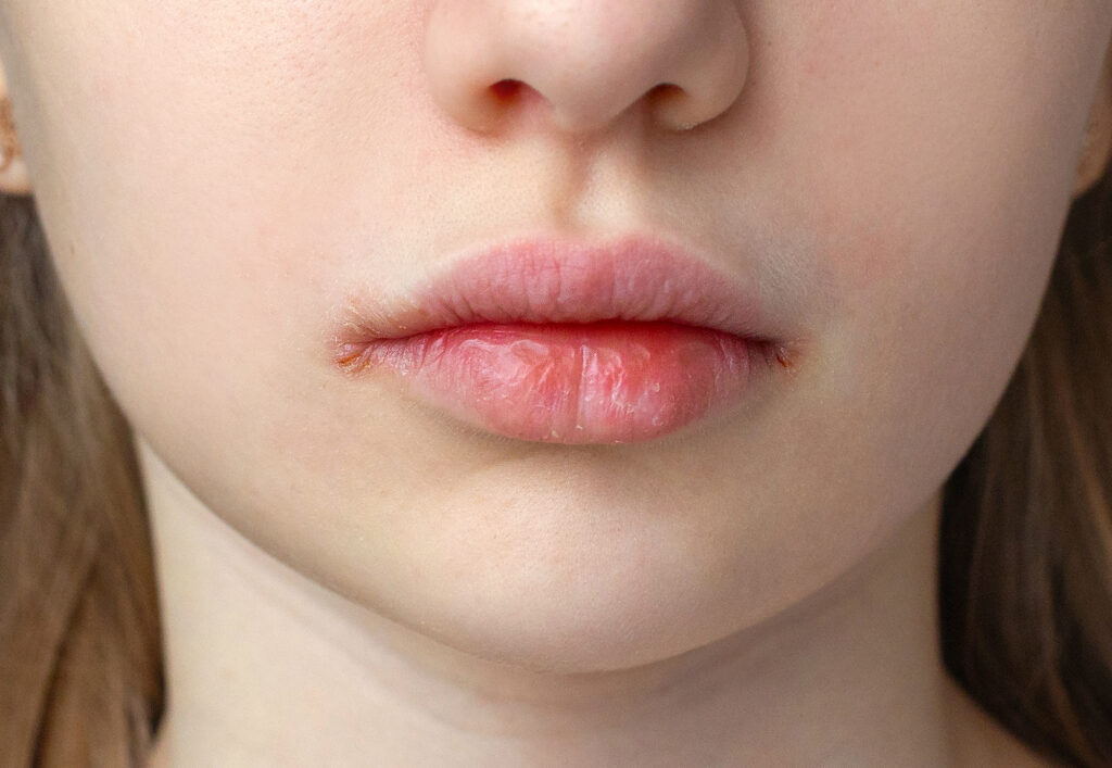 唇が乾燥している女性