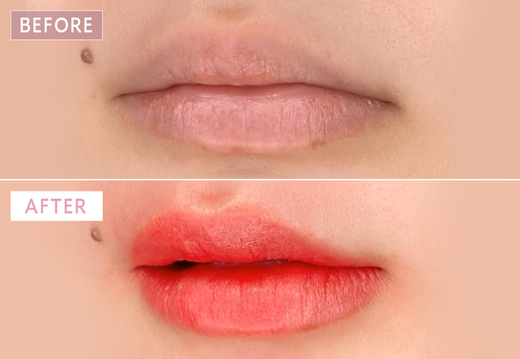 リップアートメイクの症例写真