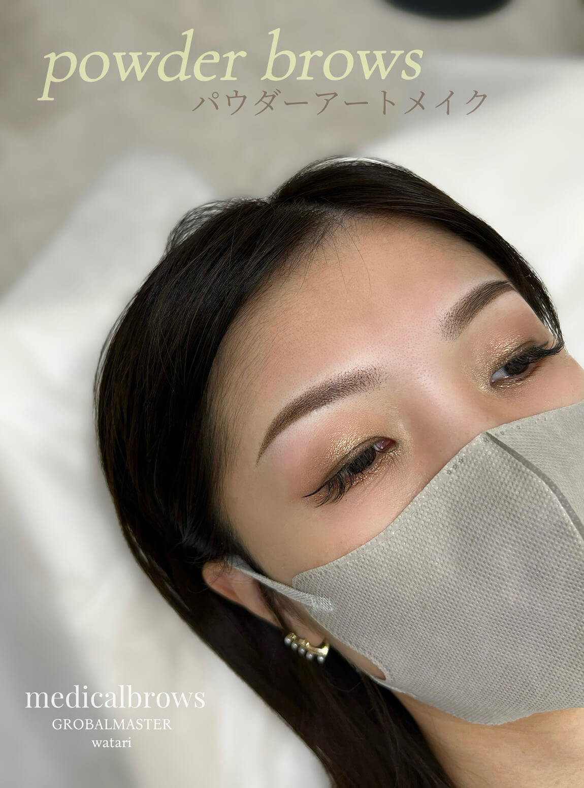 メディカルブロー 渡 症例写真1