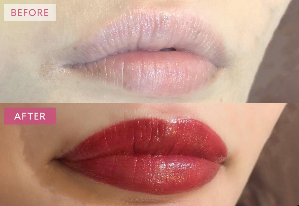 リップアートメイクの症例写真