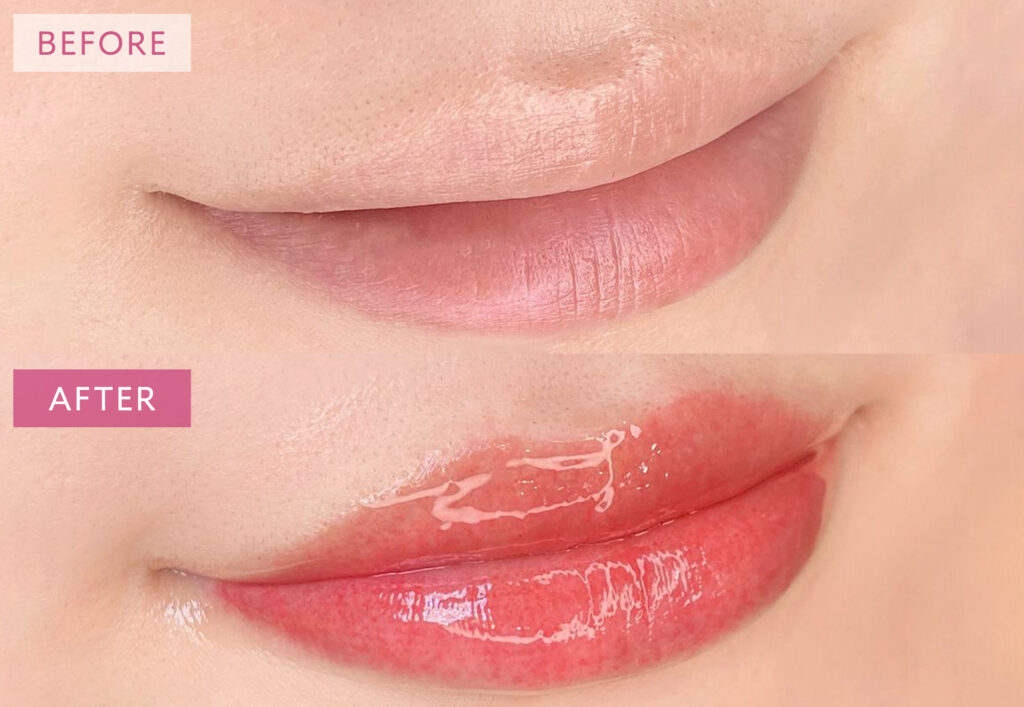 リップアートメイク症例写真