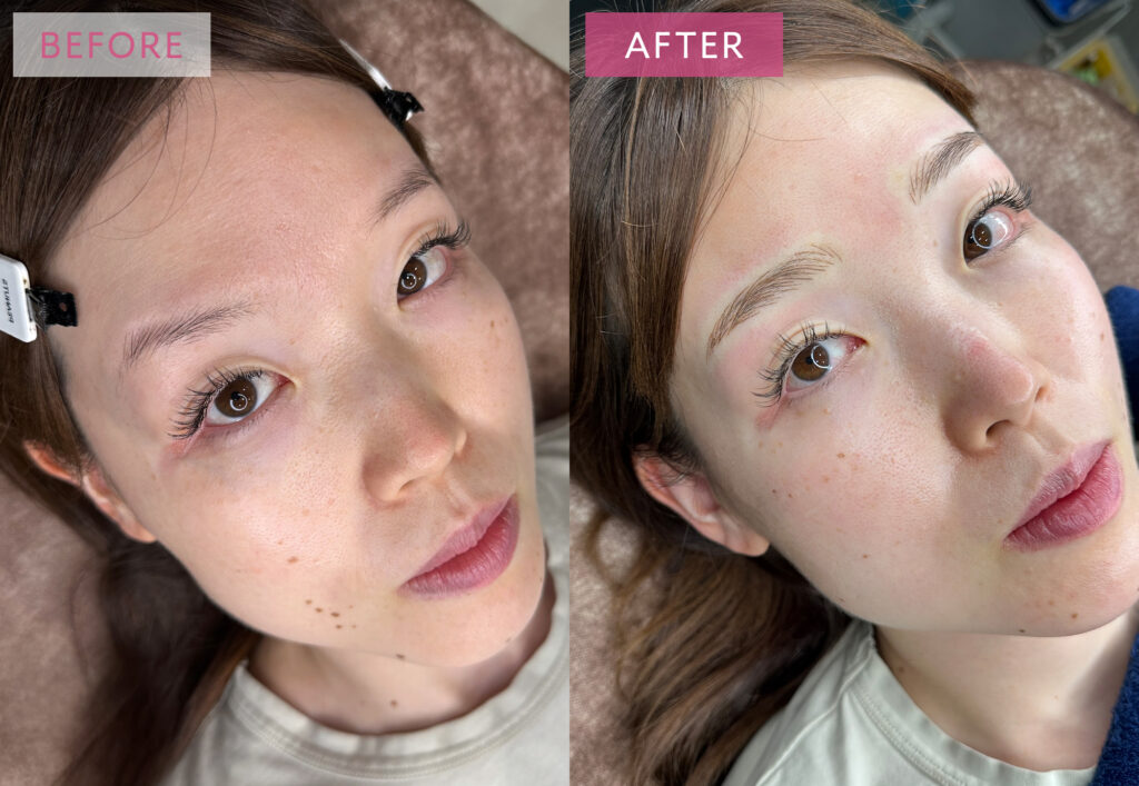 眉毛アートメイクの症例写真