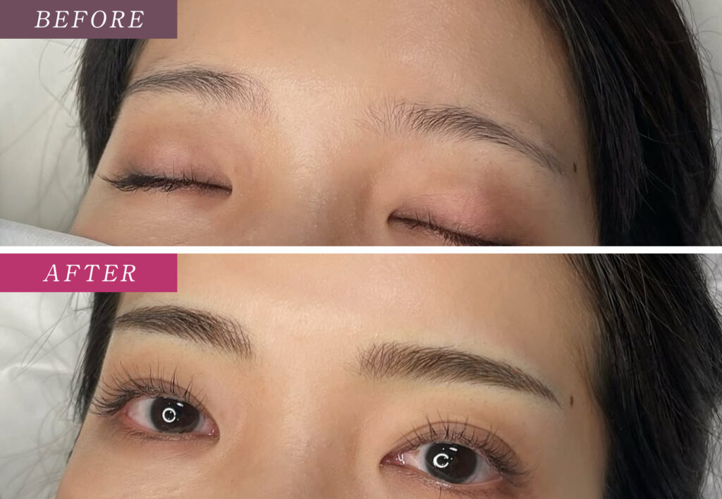 眉毛アートメイクの症例写真