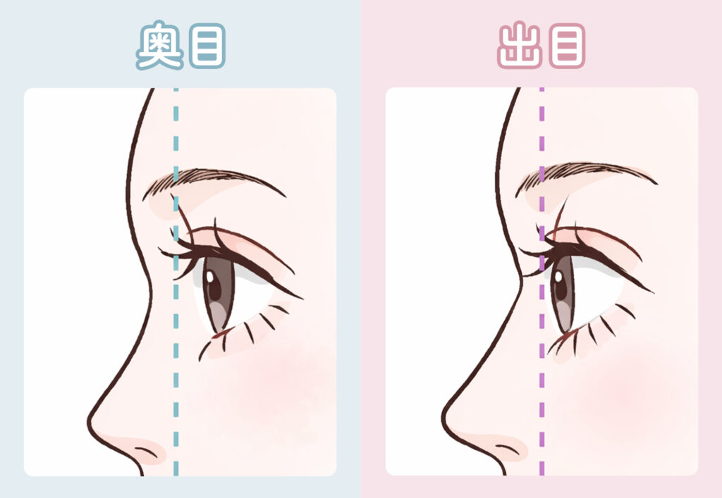 奥目と出目の見分け方